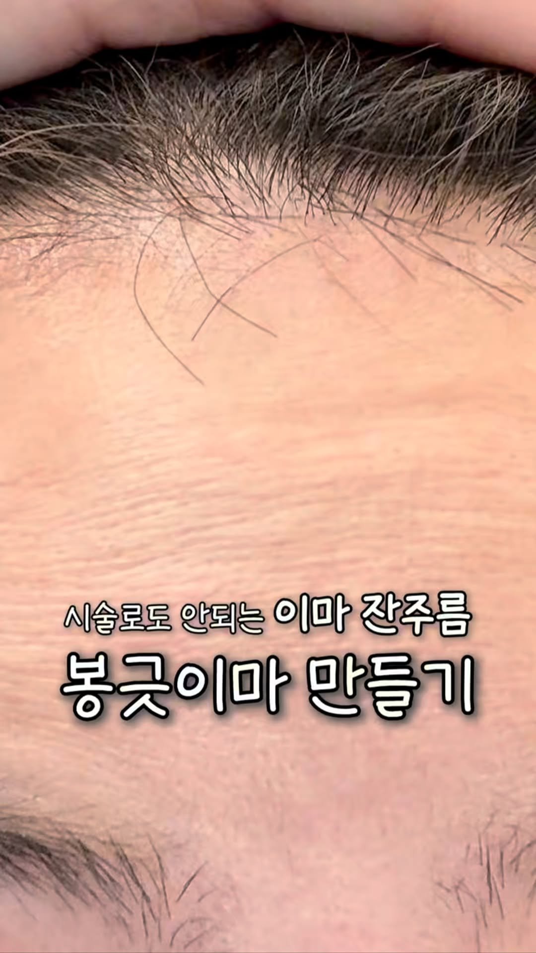 muri_l__ 게시물 이미지: 바르자마자 꿀광 떨어지는 “바르는 필러밤“
저도 애를 여러번 낳고,
살이 찌고...