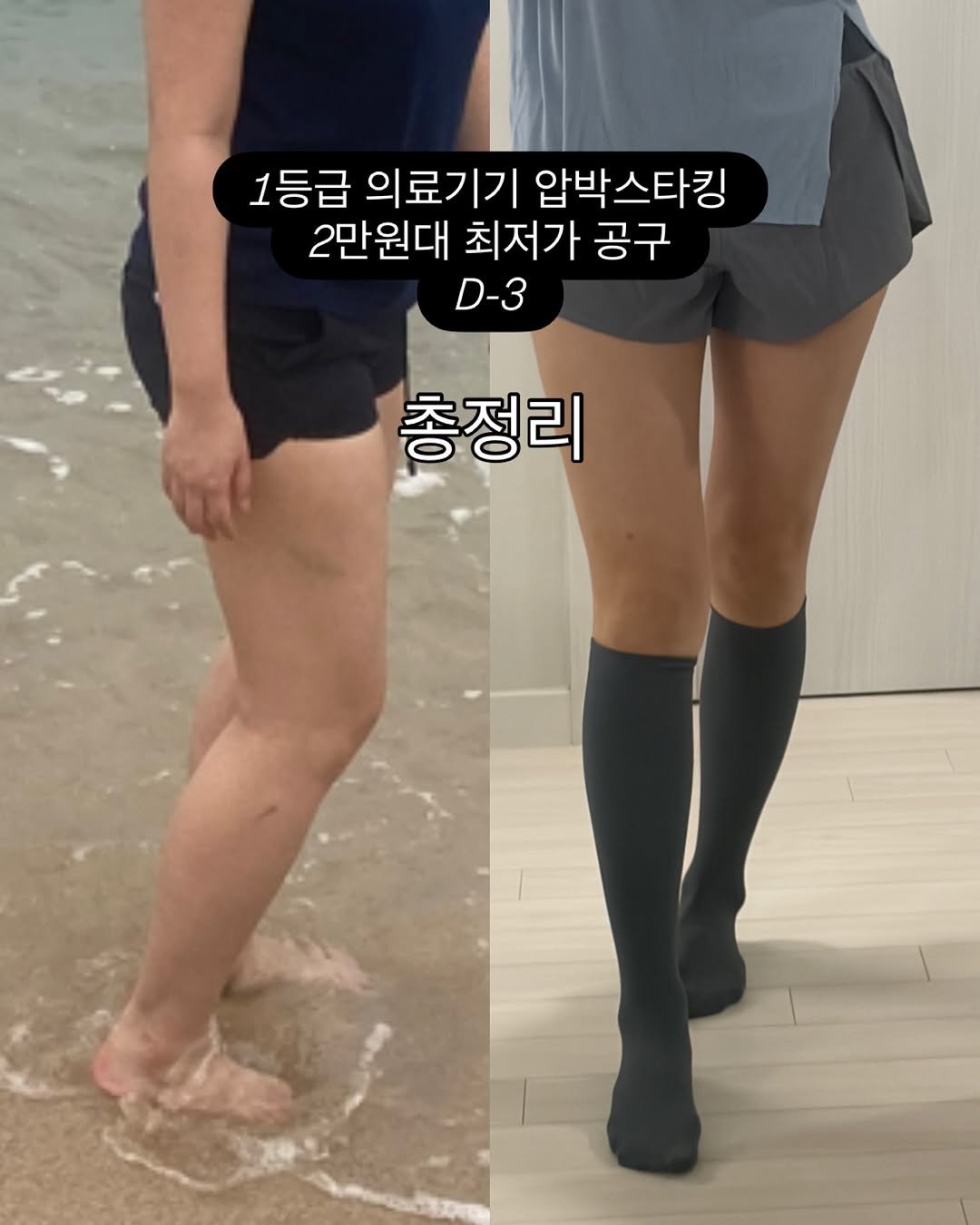 Photo by 뮤즈모브모델이 운영하는 꿀템공유소🤍 on January 14, 2026. May be an image of shorts and text that says '1등급 의료기기 압박스타킹 2만원대 최저가 공구 D-3 총정리'.