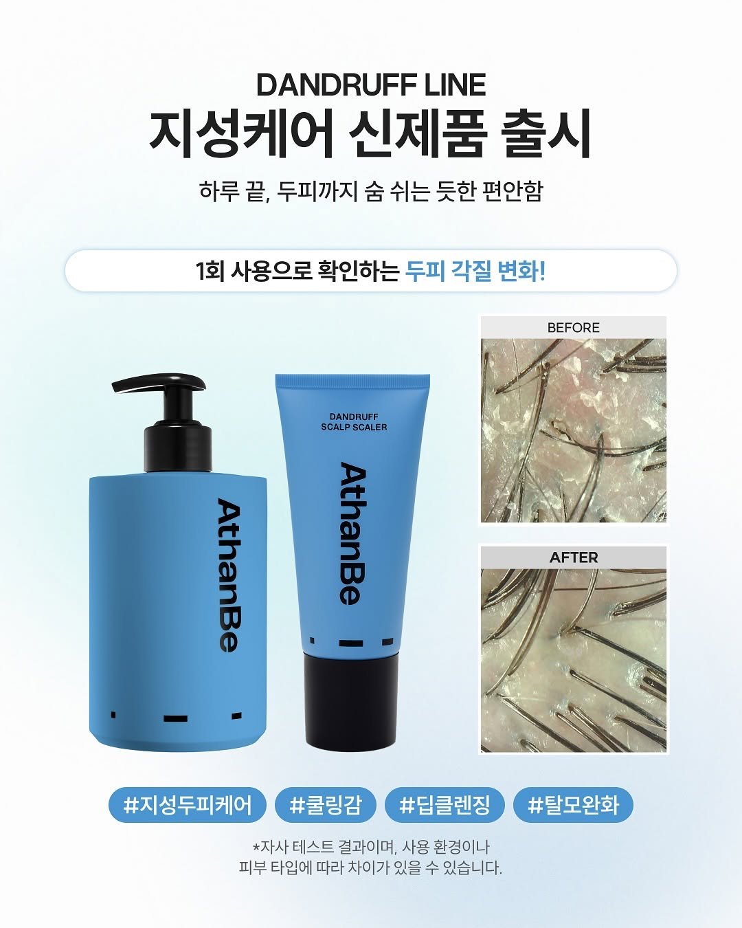 Photo shared by 묘정 on August 28, 2025 tagging @my.o_, and @athanbe_official. May be an image of hair product, lotion, hand cream and text that says 'DANDRUFF LINE 지성케어 신제품 출시 하루 끝, 두피까지 숨 쉬는 듯한 편안함 1회 사용으로 확인하는 두피 각질 변화! BEFORE S DANDRUFF SCALF SCALPSCALER SCALER AthanBe AFTER AthanBe #지성두피케어 #쿨링감 #탈모완화 #딥클렌징 *자사 테스트 결과이며, 사용 환경이나 피부 타입에따라차이가 타입에 따라 차이가 있을 수 있습니다.'.
