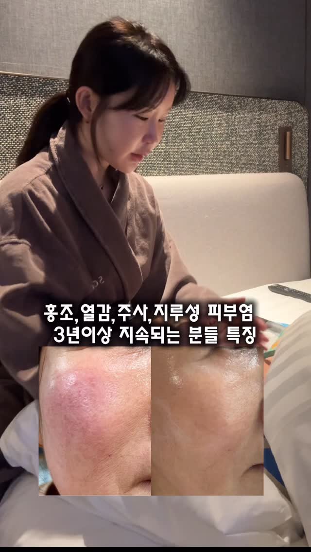 n____youse 게시물 이미지: 🔥붉고, 뜨겁고, 가렵고, 건조한 피부라면
더이상 헤매지 마시고
달빛 홍조 30일...