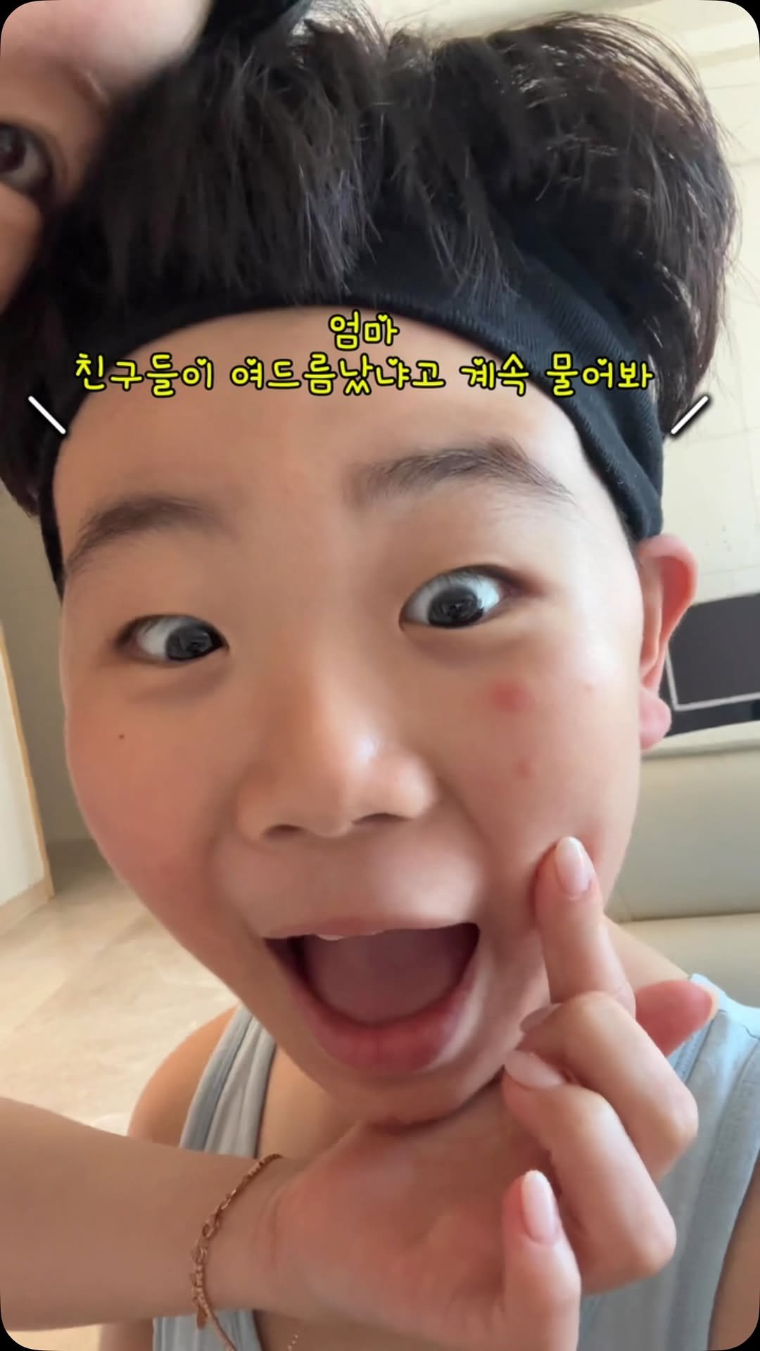 n____youse 게시물 이미지: 애들 피부 발진 한 번이라도 겪어본 엄마들은 
제 마음 아실 거예요🥹

‘이걸 계속...