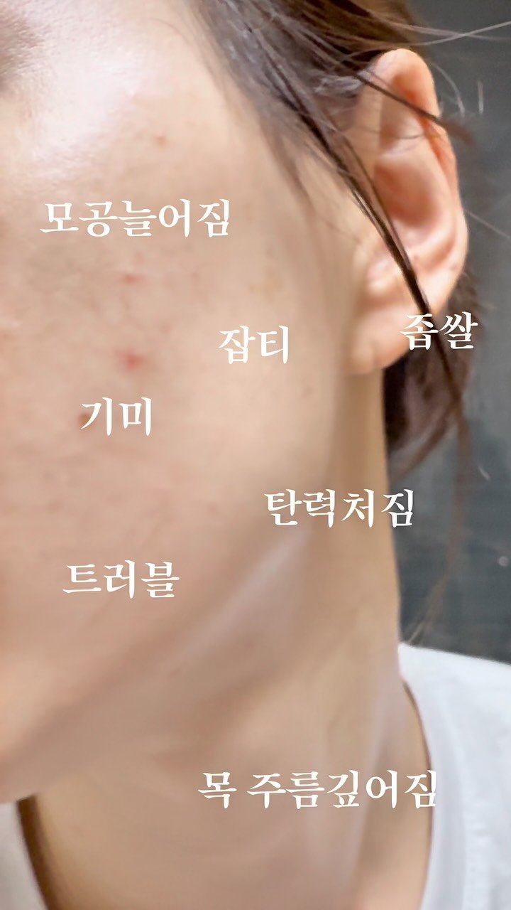 na__swane 게시물 이미지: 이번에 PTSD 올 뻔했잖아요….

광고에 하도 속아서
그동안 실패한 화장품이 몇...