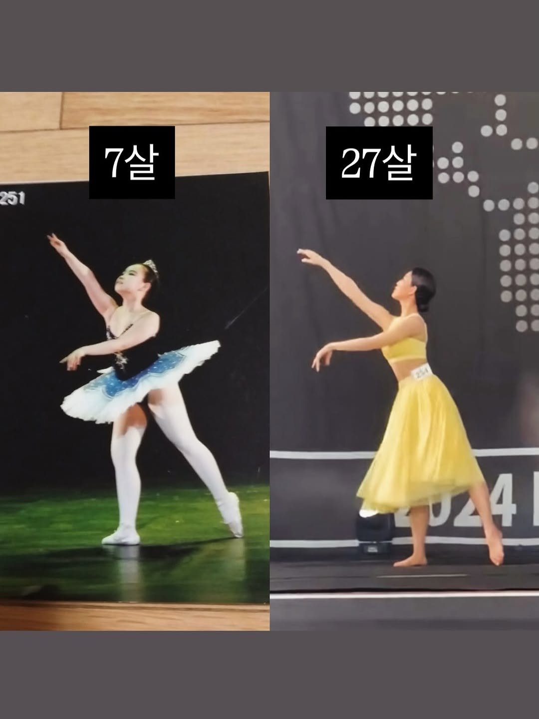 nana__fit_ 게시물 이미지: 소싯적 무용하던 시절🩰
유치원 때 예쁜 발레복을 입고 
슈즈를 신고 무용하는 게...