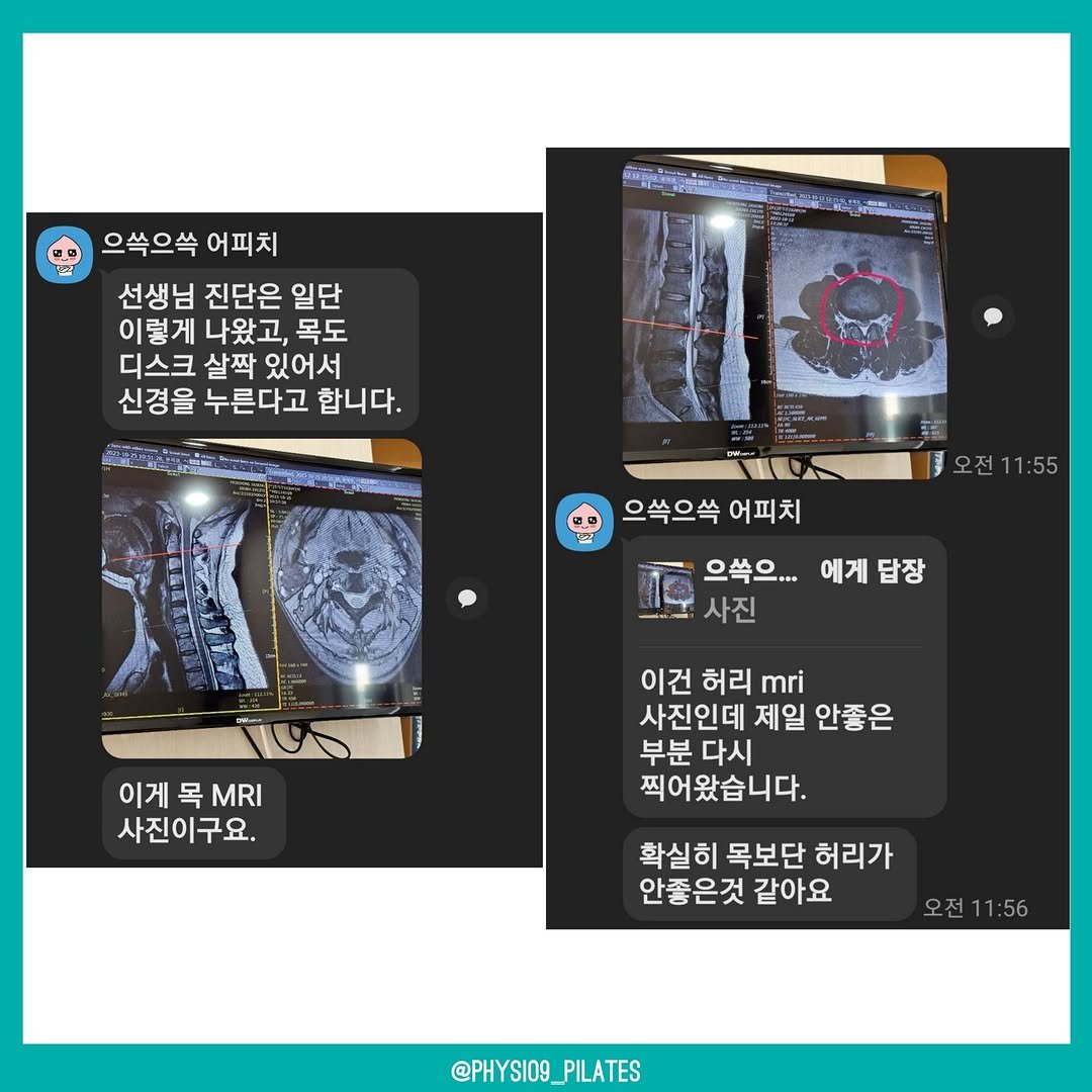 ninephysio 게시물 이미지: 처음 허리,목이 너무 안좋아서 아버님 소개로 방문하신 재경님, 하지 방사통도,...
