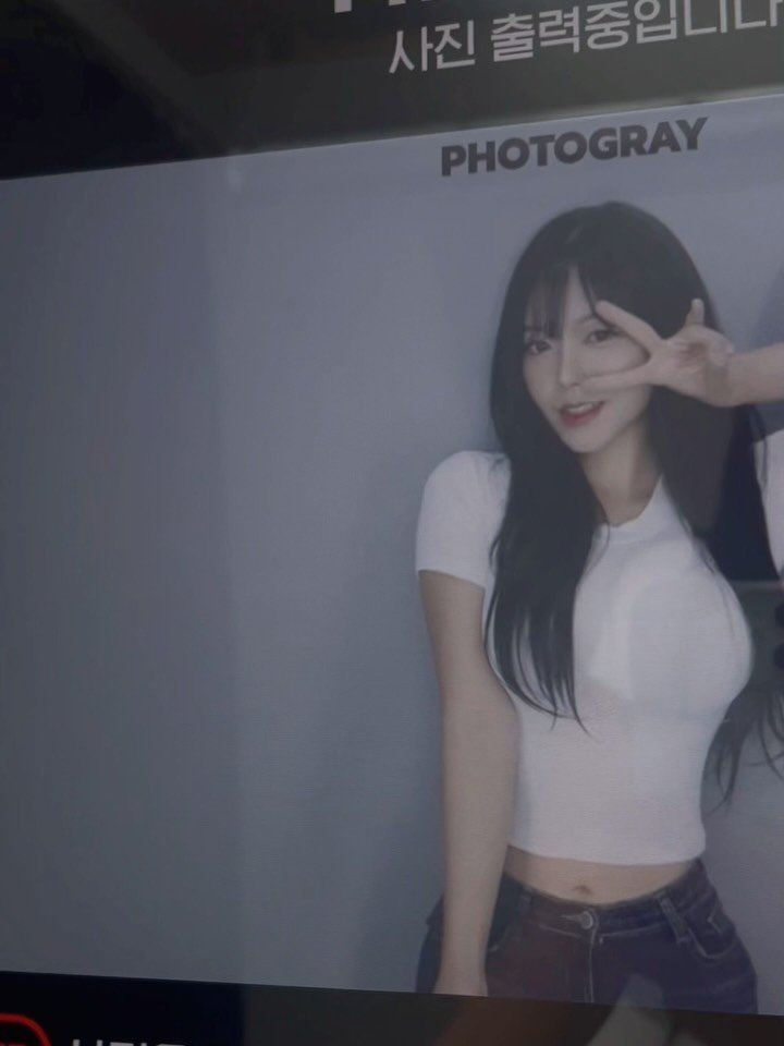 nireyh_____ 게시물 이미지: 점점 얼굴선이 무너지는 느낌이라 맞아 본 #캇주사 맞아보니 얼굴선도 잡아주고 콧대도...
