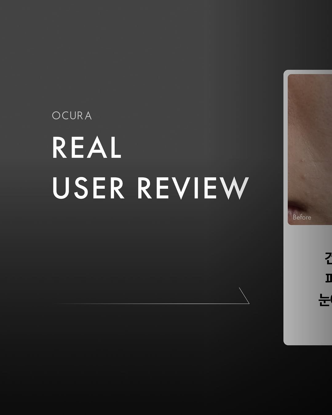 ocura.kr 게시물 이미지: 후기가 증명합니다.
진짜 효과가 있을까 고민되셨다면,
광고 아닌 내돈내산 후기부터...