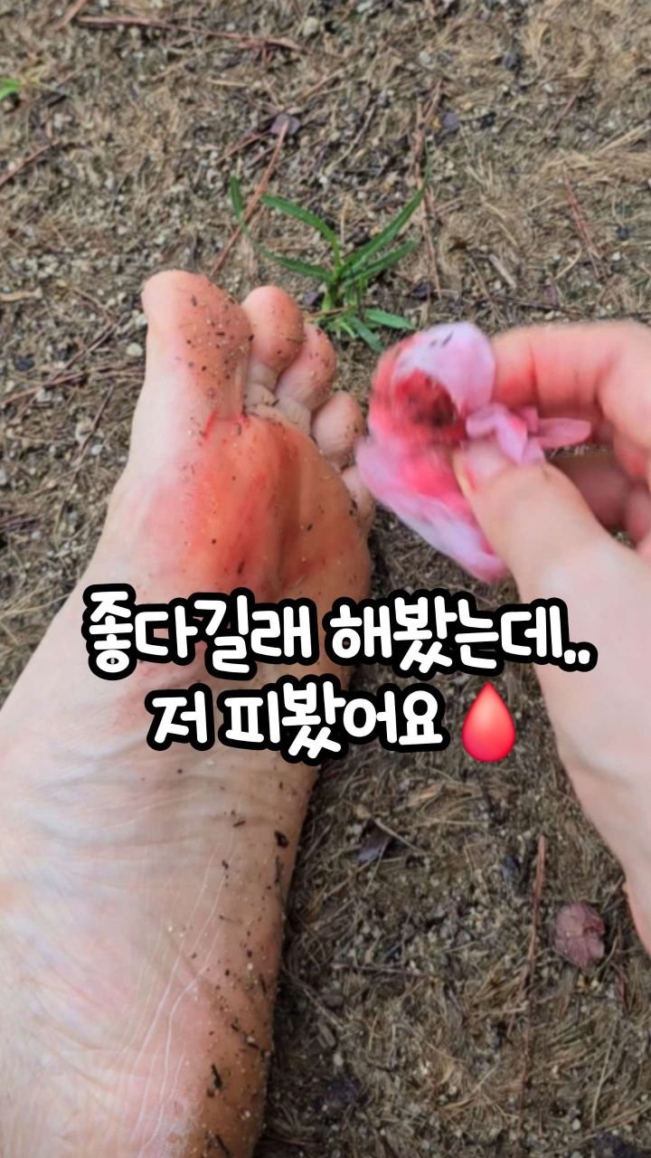 oddukmom 게시물 이미지: 👣 “맨발걷기 좋다해서 해봤는데… 저 피봤어요🩸”

❄️ 겨울엔 바닥이 얼음장...