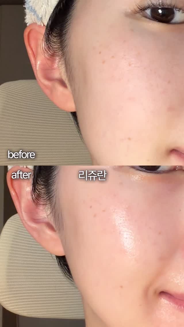 off.yejin 게시물 이미지: #씻는것도 사치인 요즘, 간편하게 반짝이는 피부를 만들 수 있는 리쥬란 듀얼 이펙트...