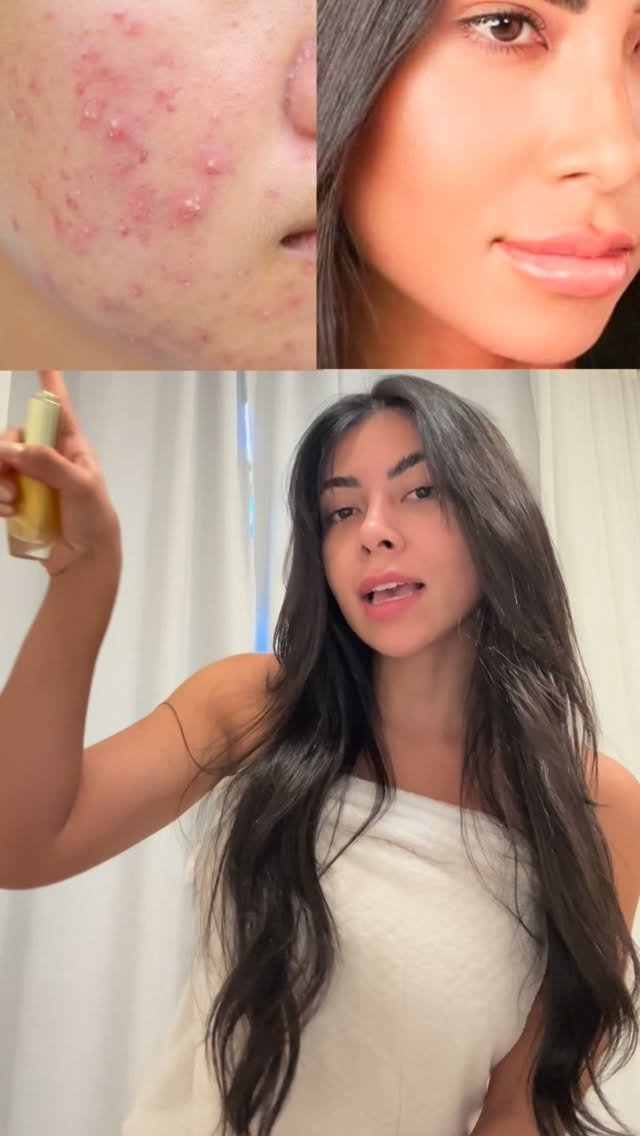 oharaingrid 게시물 이미지: Sérum Facial Regenerativo Premium Ácido...