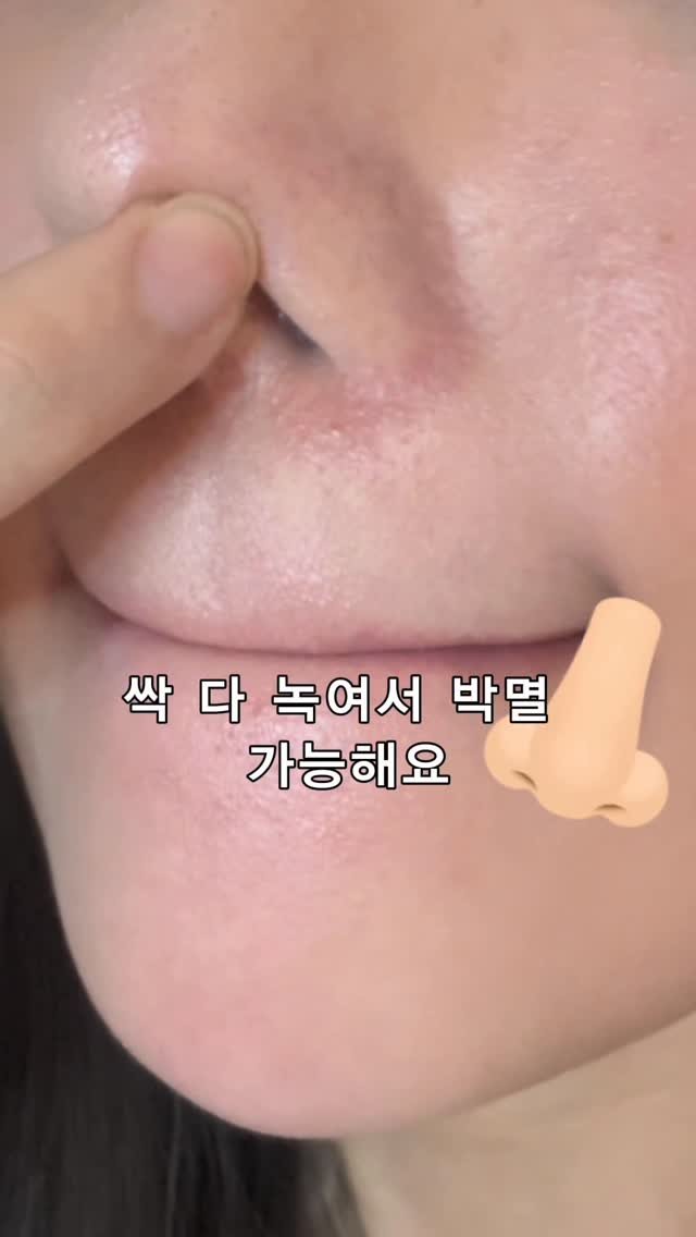 olheum_ceo 게시물 이미지: 3년째 쓰고있는 비밀병기
바로 박멸밤 ..🛠️

코, 턱, 미간에 이런거...