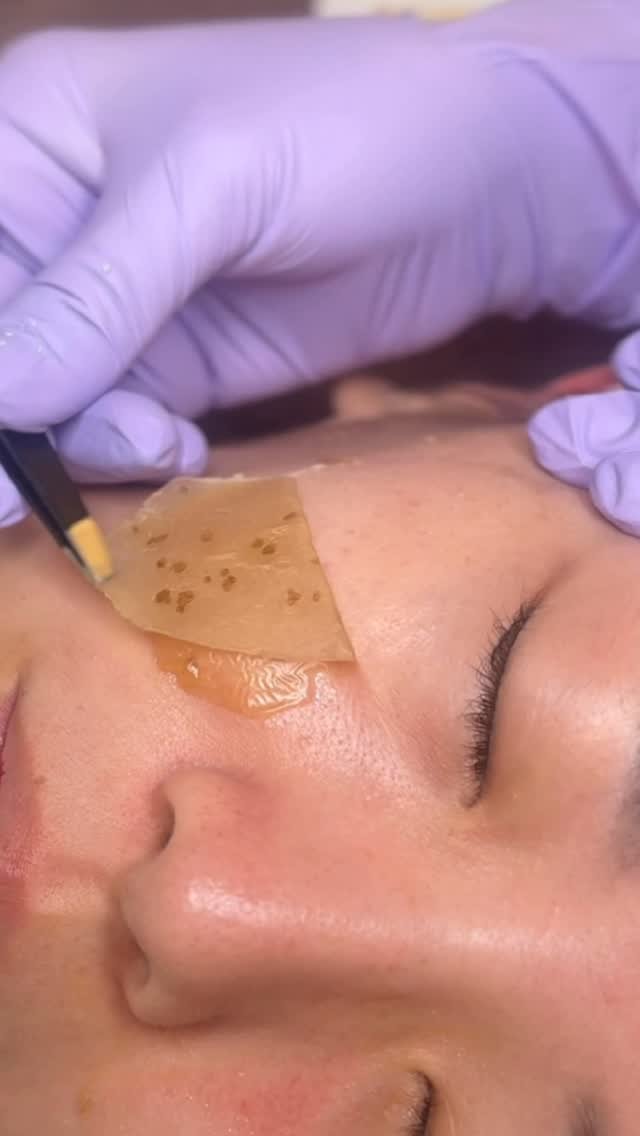 olheum_ceo 게시물 이미지: ❌주근깨는 관리가 어렵다?
이 영상, 단1회 관리 후 변화입니다.

⭕️아래 댓글...