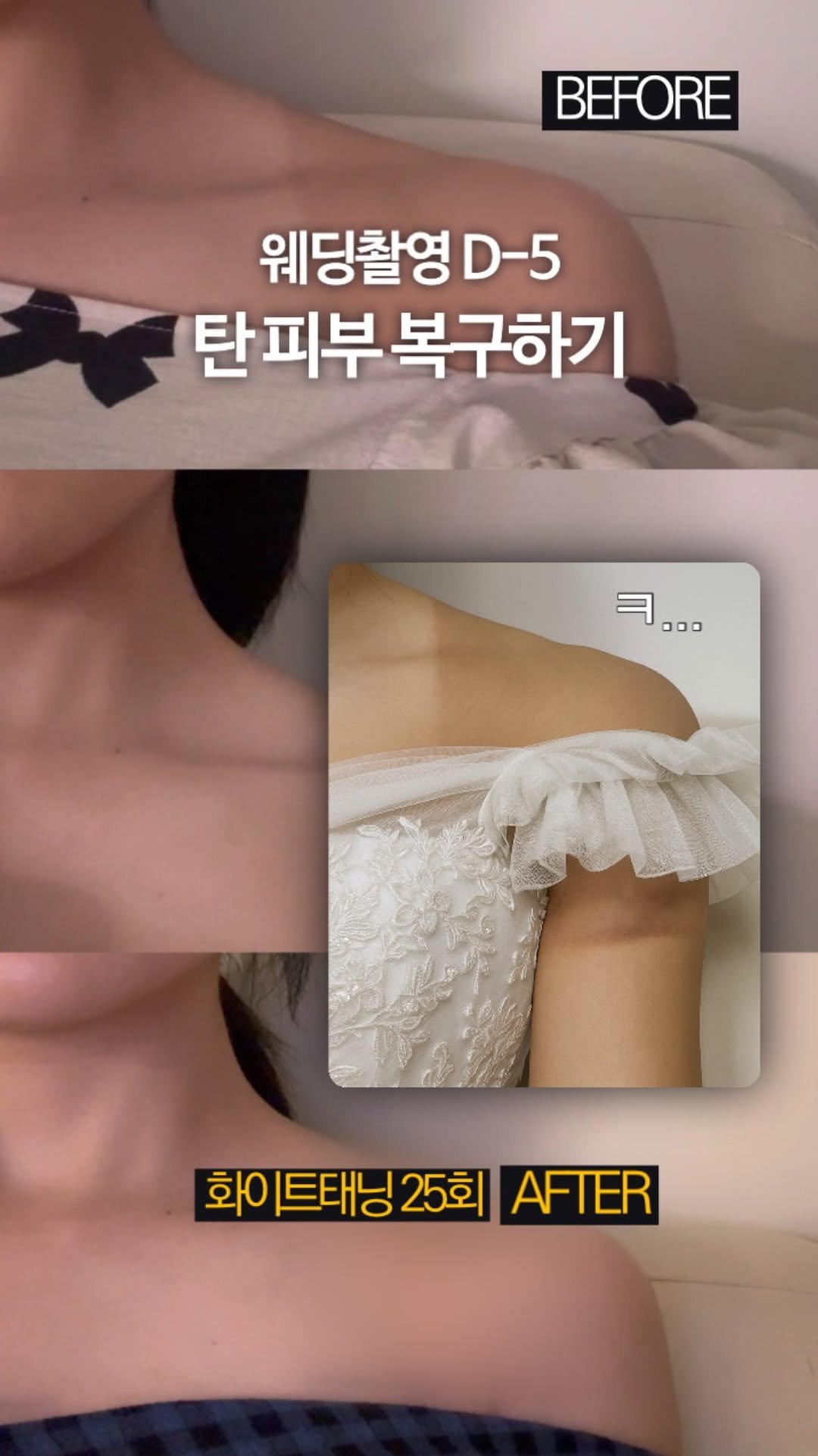 olivxchoi 게시물 이미지: 웨촬 D-5 하얀 신부 되기 (화이트태닝 한달 후기)

좀 더 드라마틱하면...