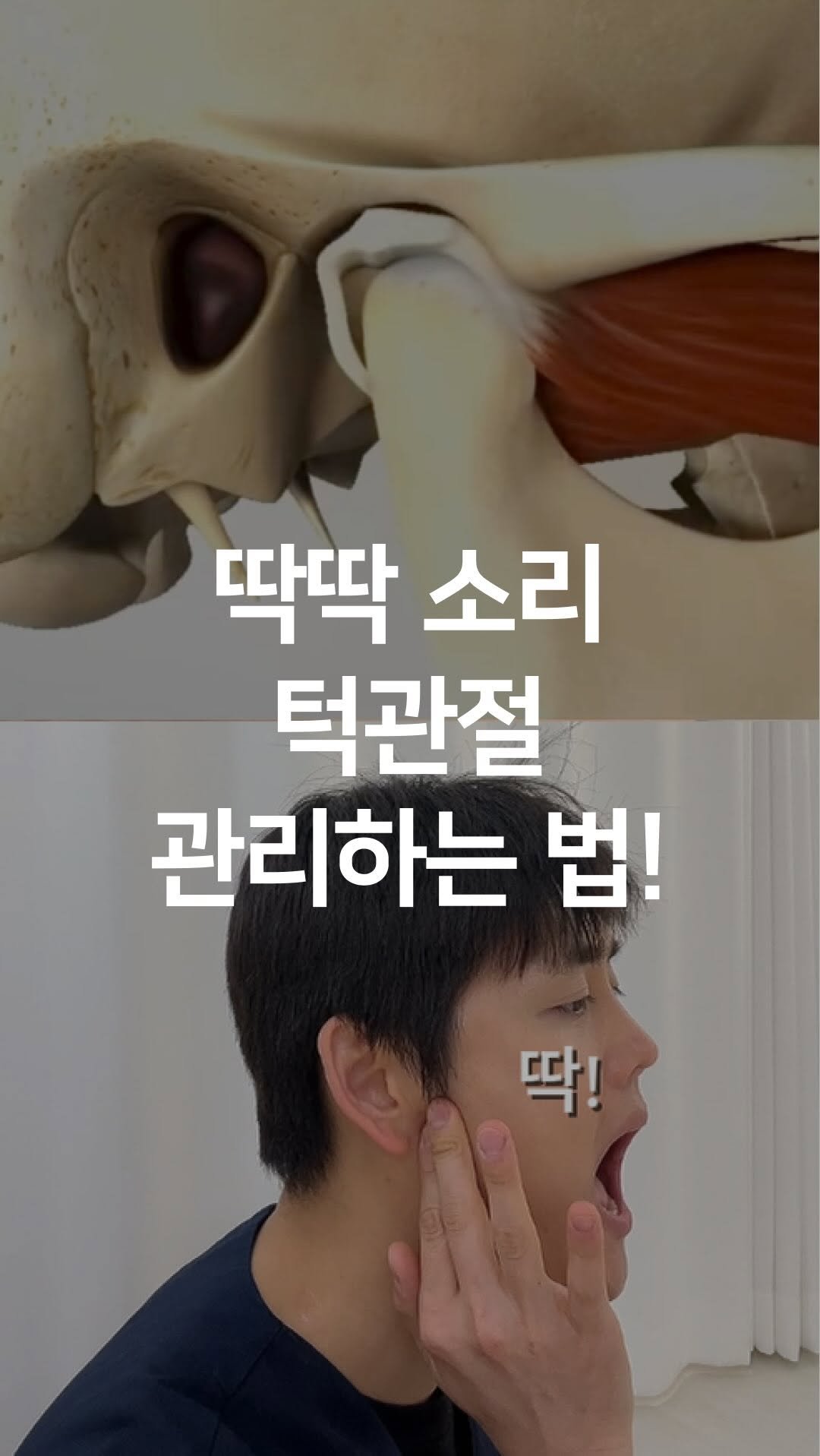 one_dosu_physio 게시물 이미지: 혹시 턱에서 '딱딱' 소리 나나요? 방치하면 얼굴 무너집니다! 

턱관절은 우리...