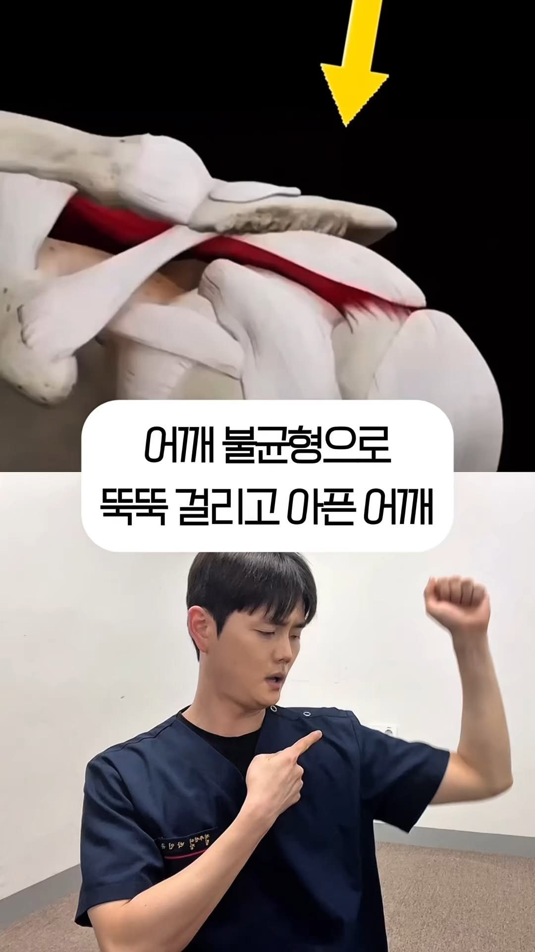 one_dosu_physio 게시물 이미지: 팔 올릴 때 어깨에서 소리 나는 분들! 1분이면 됩니다

팔을 들 때마다 어깨에서...