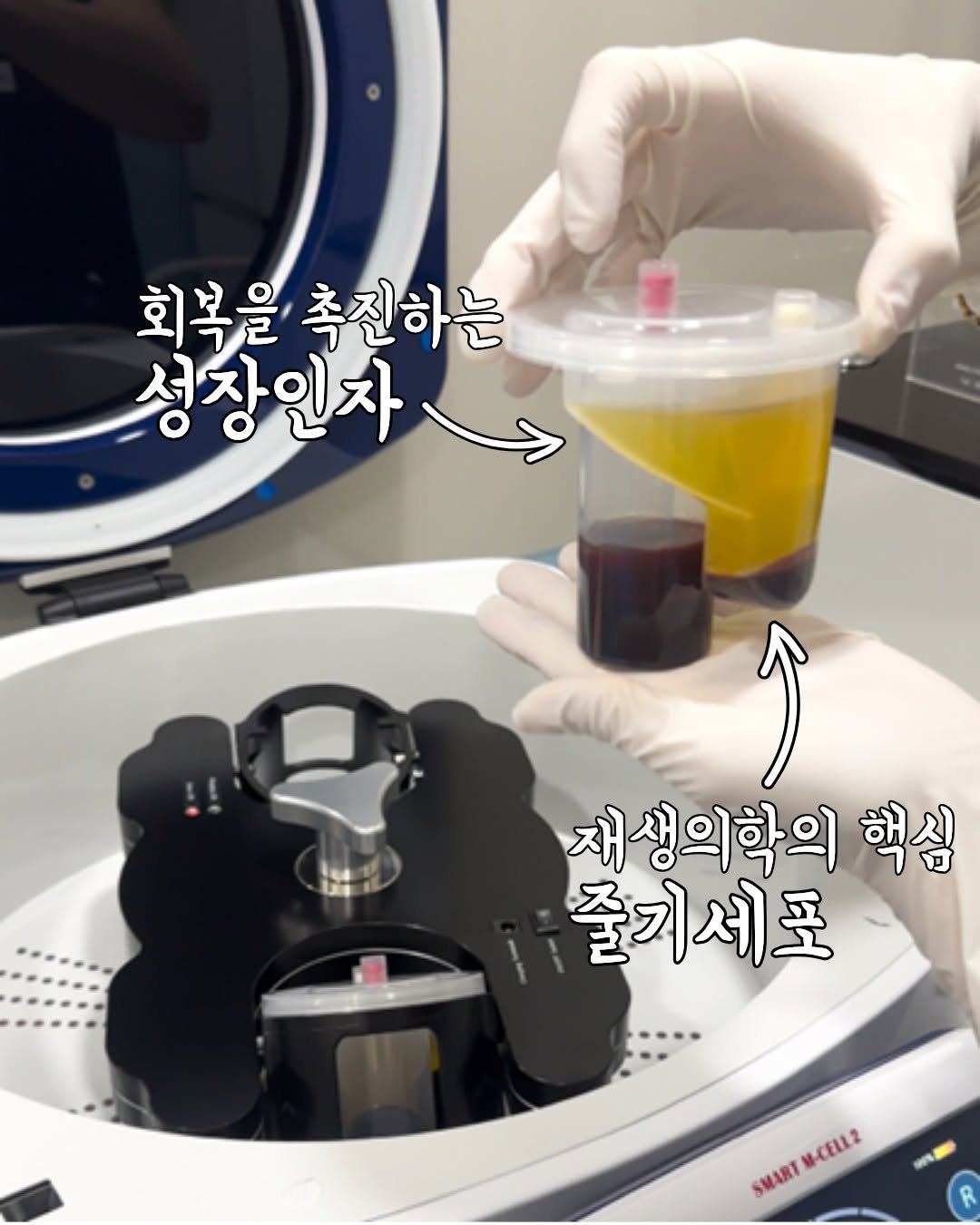 onul_ps 게시물 이미지: 골수 또는 혈액을 통해 우리 몸의 회복과 재생,세포의 분화를...