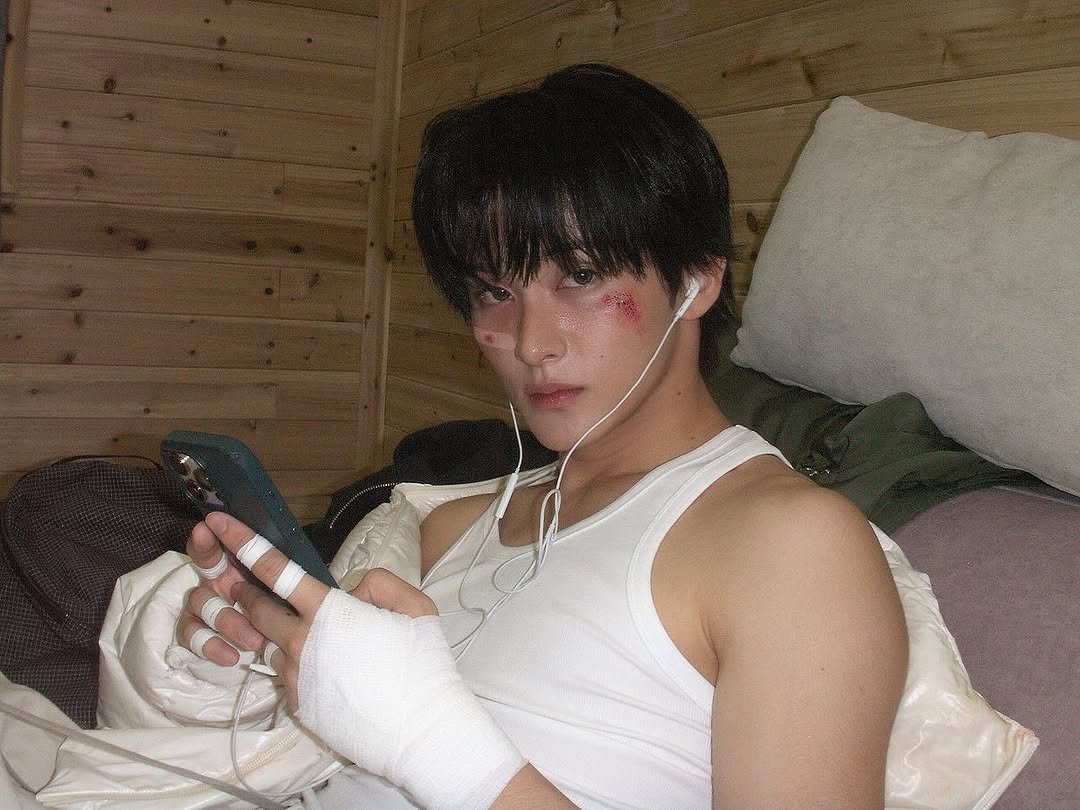 Photo by Mark on December 05, 2025. May be an image of phone, cigarette, bandage and text.