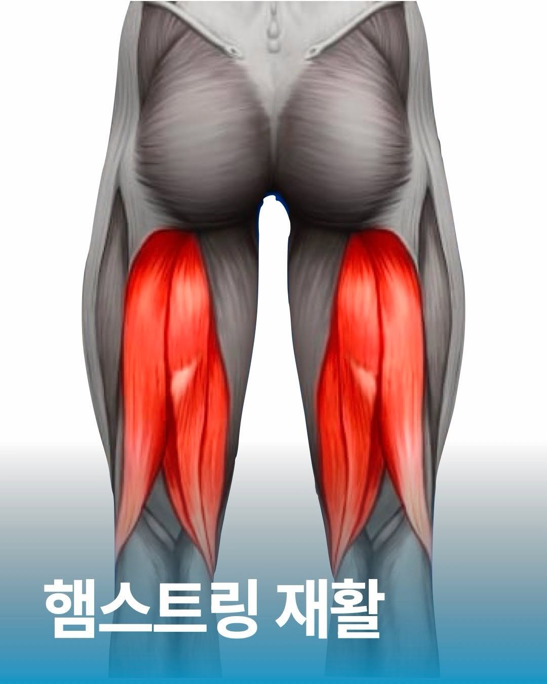 orca_physio 게시물 이미지: 햄스트링 재활을 해보자!

다들 햄스트링 자주 다치십니까? 운동을 자주한다면,...