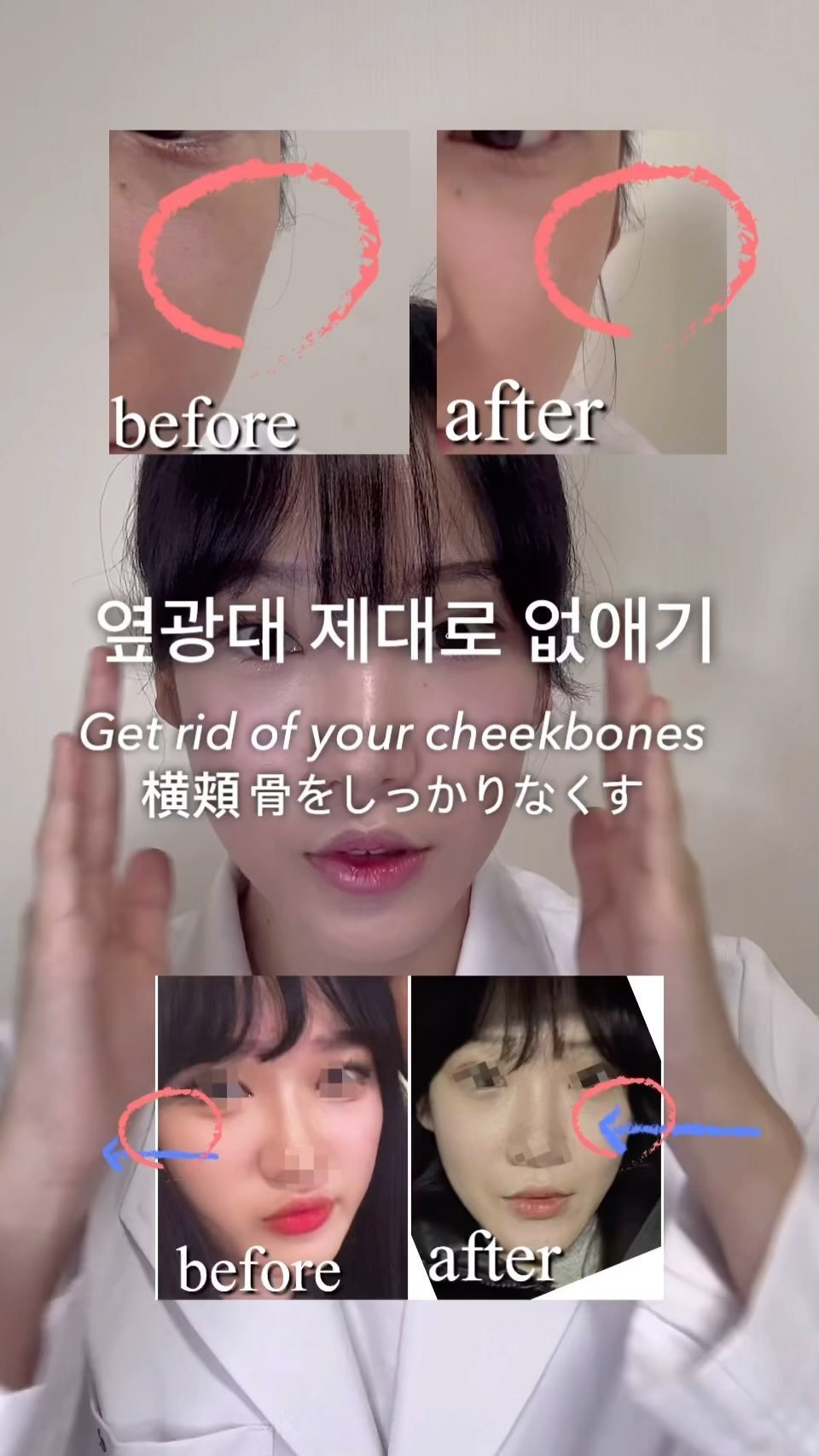 pearl._.h_ 게시물 이미지: ☑️옆광대 제대로 부시기

📌옆광대가 커지는 원인

1. 양반다리
2. 견갑골...