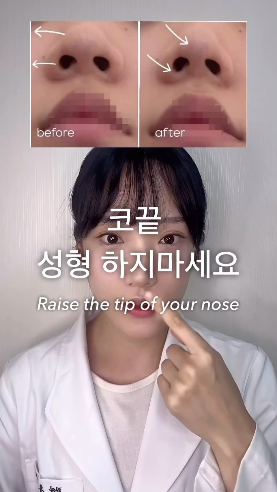 pearl._.h_ 게시물 이미지: ☑️ 코끝(콧날개) 높이기 

코끝은 코중격 내림근이 뭉치면 코끝의 연골과...