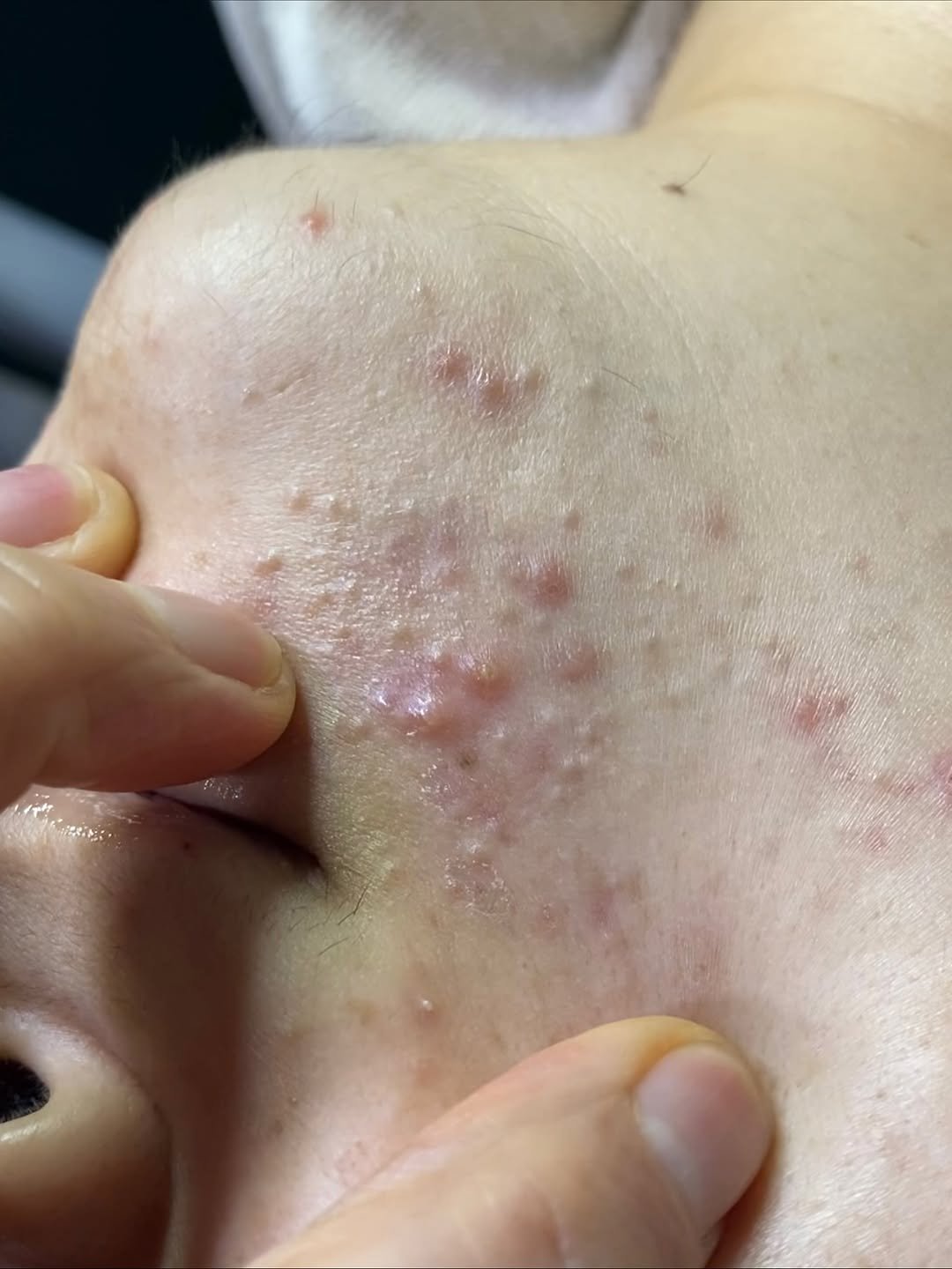 Photo by 박정민/여드름/문제성피부전문가 on November 16, 2025. May be an image of text.