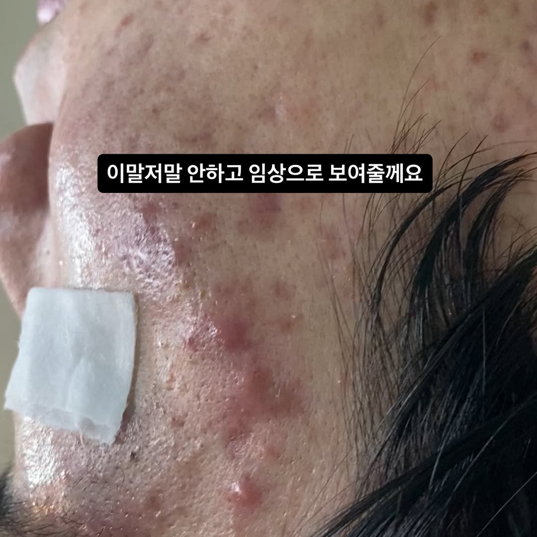 Photo by 박정민/여드름/문제성피부전문가 on January 09, 2026. May be an image of text that says '이말저말 안하고 임상으로 보여줄께요'.