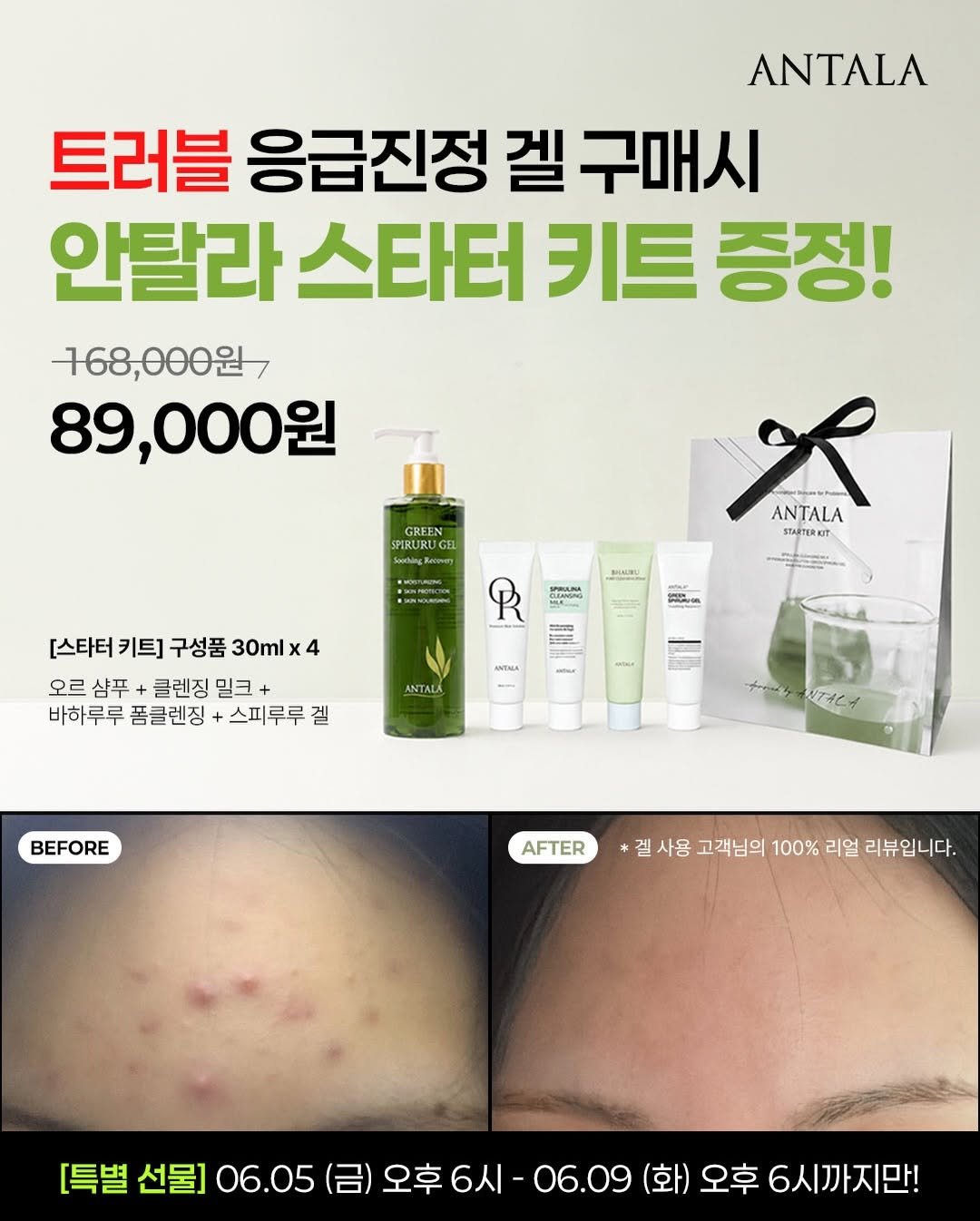 peau_jungmin5709 게시물 이미지: 6월 첫주 공구 대박

스피루루겔 공구가에 구매하고 스타터키트 받기

➡️안탈라...