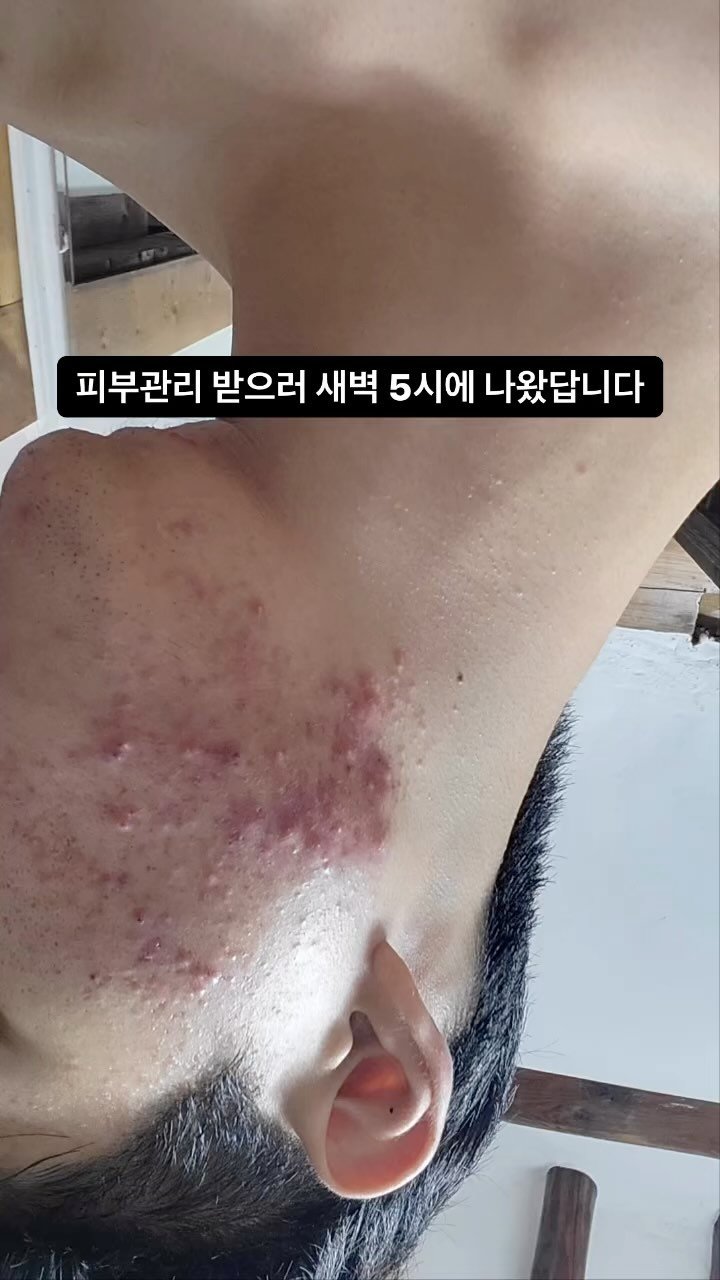 peau_jungmin5709 게시물 이미지: .
.
우리고객님은 부산에서 아주 먼곳에서 오시는데 교통편이 그리좋은곳이 아니어서...