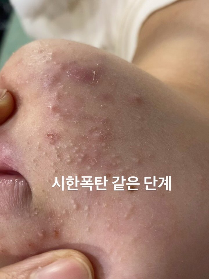 peau_jungmin5709 게시물 이미지: (현 피부전공 대학교수의 문제성피부관리)

1단계부터 5단계까지 차곡차곡 올라가지...