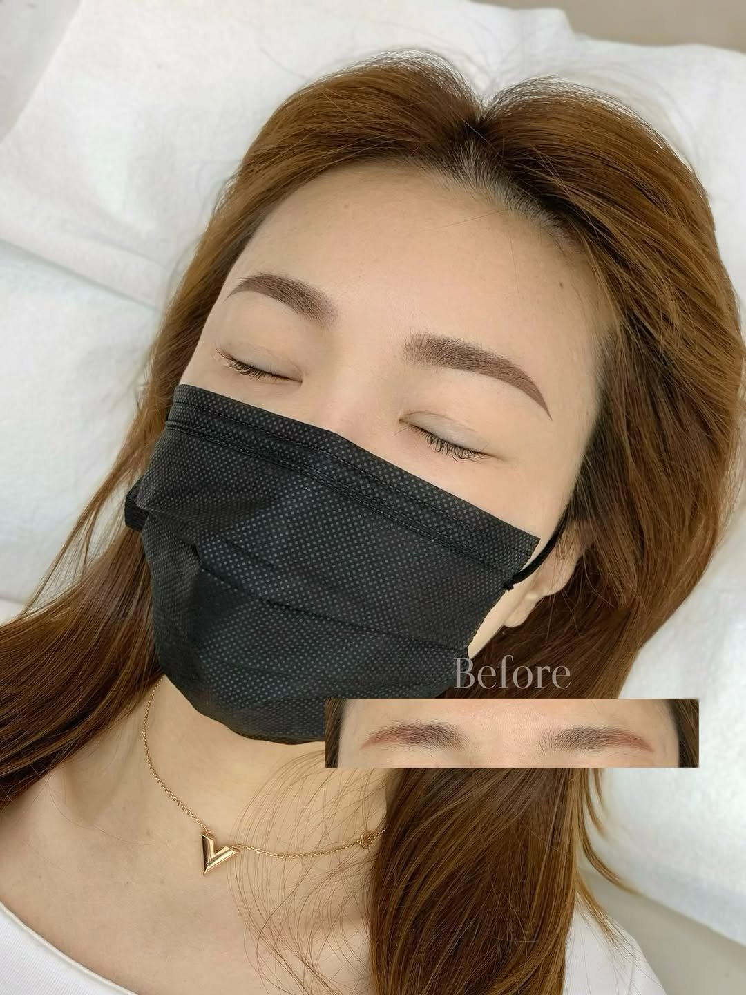 permeate_seomyeon 게시물 이미지: 10년 전 받은 눈썹 잔흔이
붉은 형광빛과 탁한 색으로 남아
눈썹만 유독 튀어...