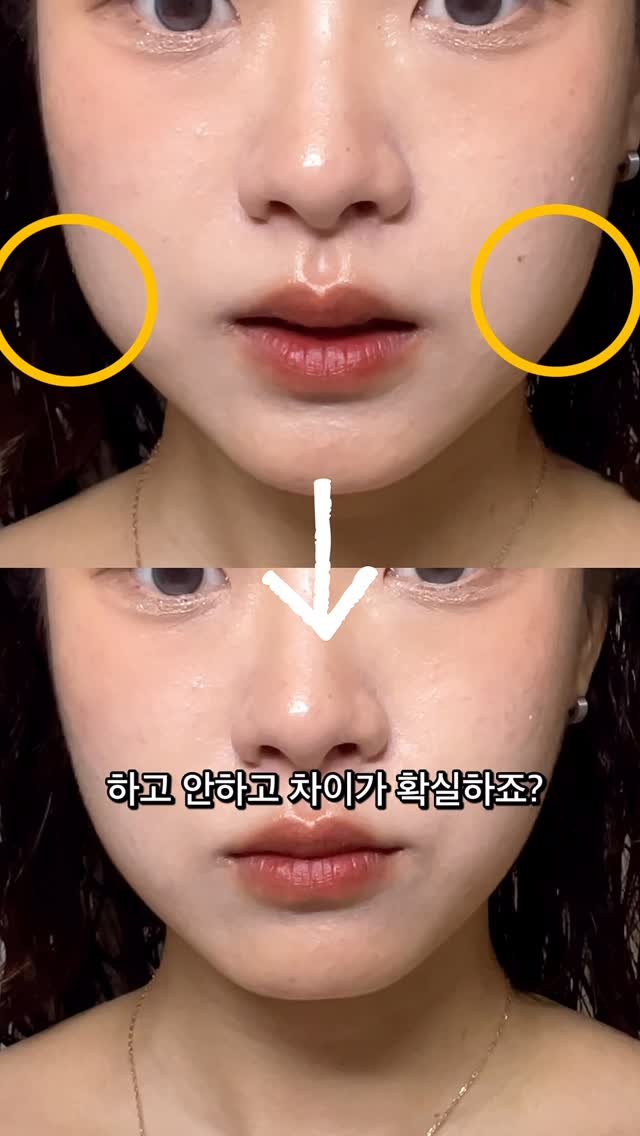 physila_sh 게시물 이미지: 날이 더워지고, 얼굴도 축 쳐지는데 얼굴살이 쳐진다고 윤곽관리만 해야할게...
