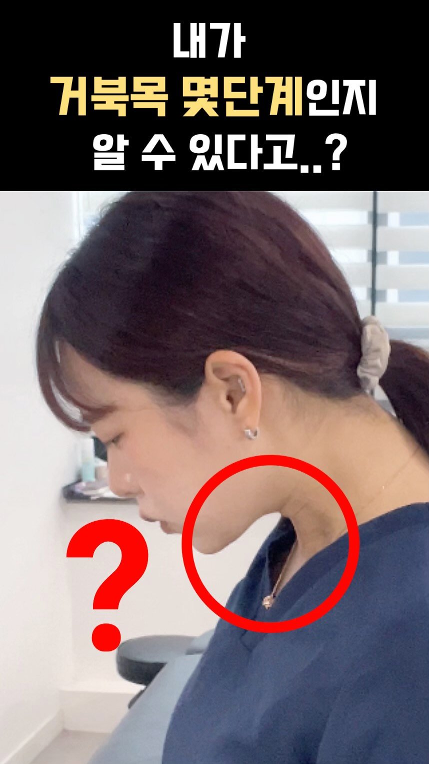 physila_sh 게시물 이미지: 🆘🚨나는 거북목 몇단계일까?🚨🆘
지금 바로 10초만에 확인해보세요🙌

고개를 가볍게...
