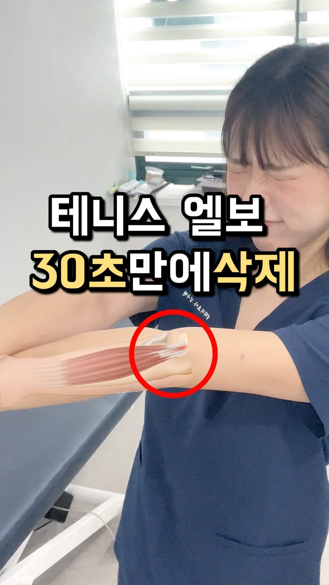 physila_sh 게시물 이미지: 🎾팔꿈치가 드디어 숨쉬는것같아….💪

팔꿈치 바깥쪽이 찌릿하거나 물건을 들 때...