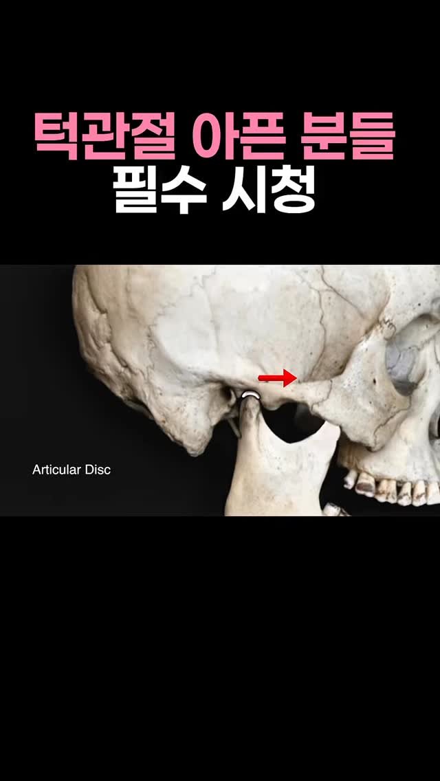 physio__roy 게시물 이미지: 이건 꼭 끝까지 보길

#턱관절 #턱관절치료 #턱관절교정 #턱관절장애 #턱관절소리...