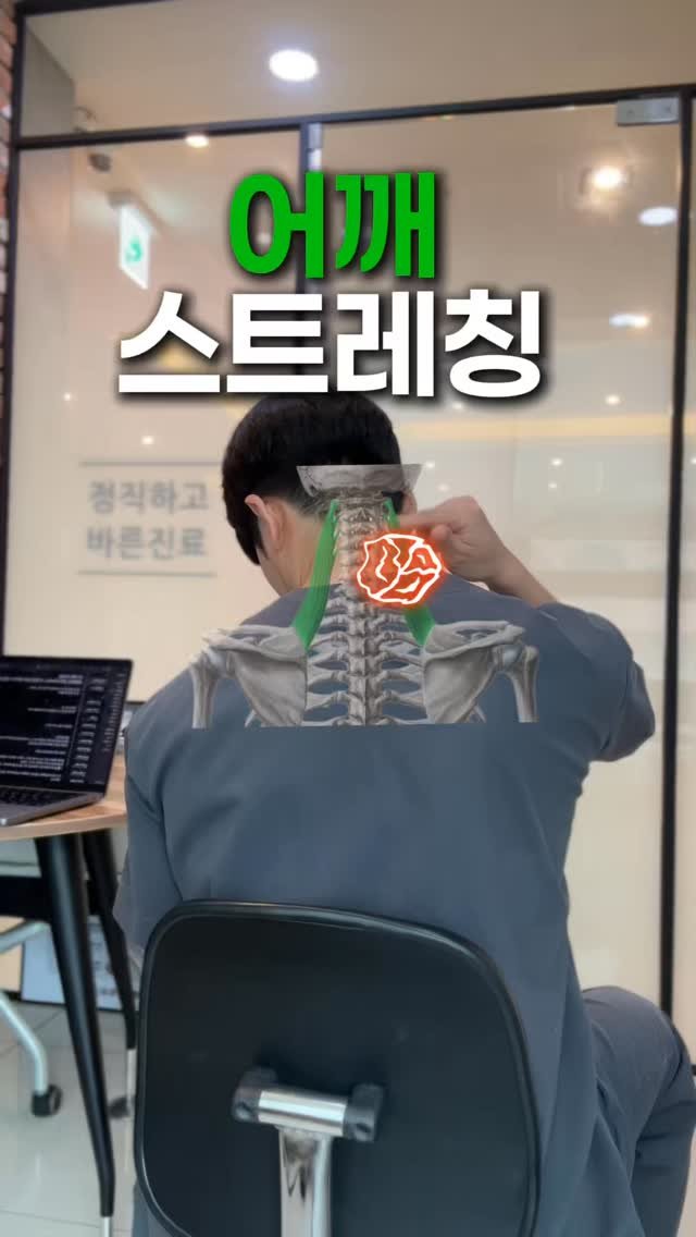 physio__roy 게시물 이미지: 전거근 운동전 스트레칭 마지막 시리즈

몇번 계속 보고 해봐야 쉬워짐

첨엔...
