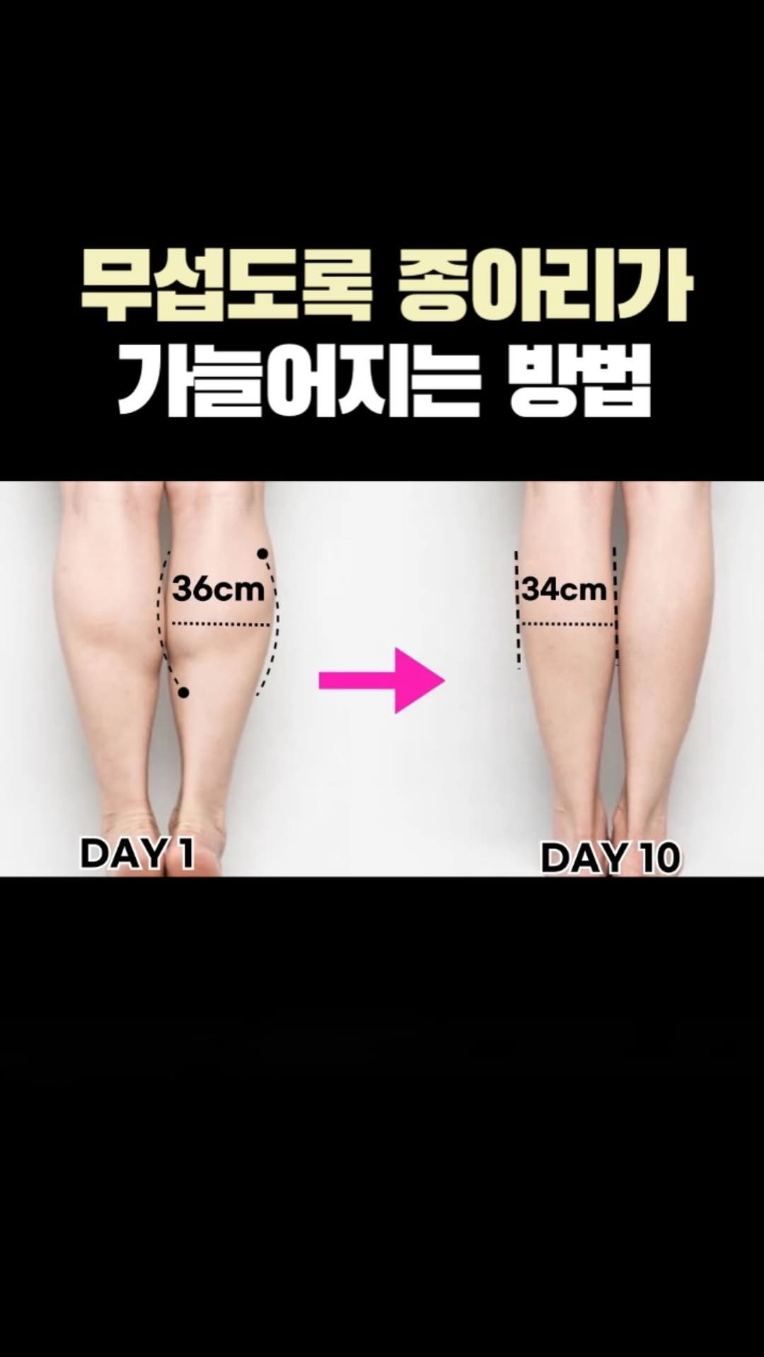 physio_pilosophy 게시물 이미지: 📌종아리 보톡스 말고 “이걸” 하세요

유독 종아리만 발달되었거나, 운동을 하면...