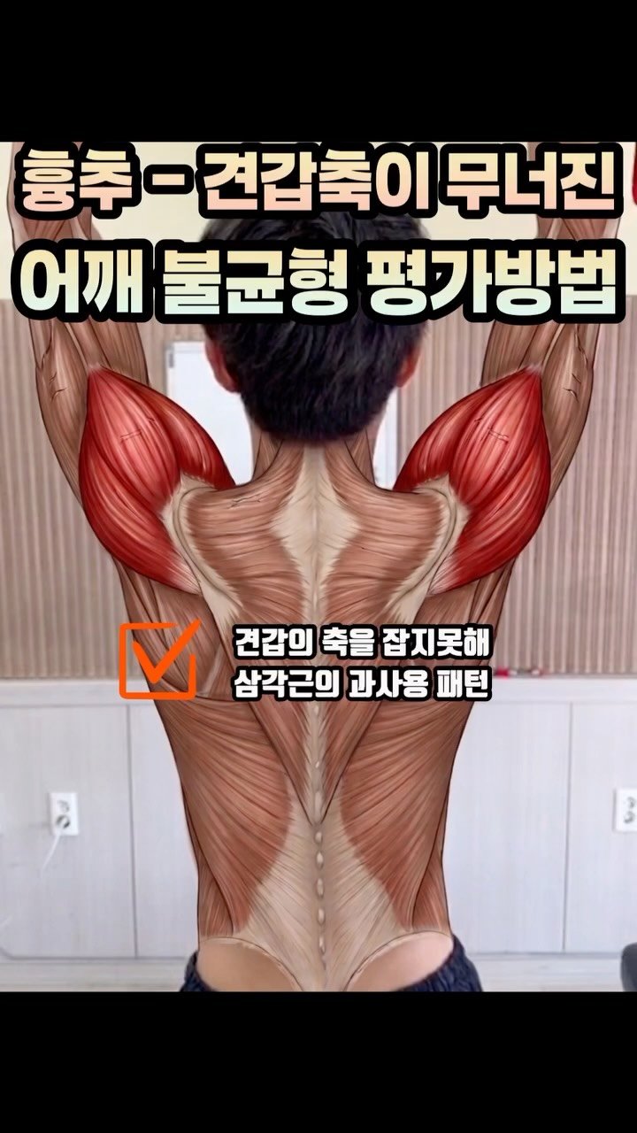 physiolution_21 게시물 이미지: 흉추 견갑 축이 무너진 어깨 불균형 확인 하는 법

1. 앞으로 나란히 상태에서...