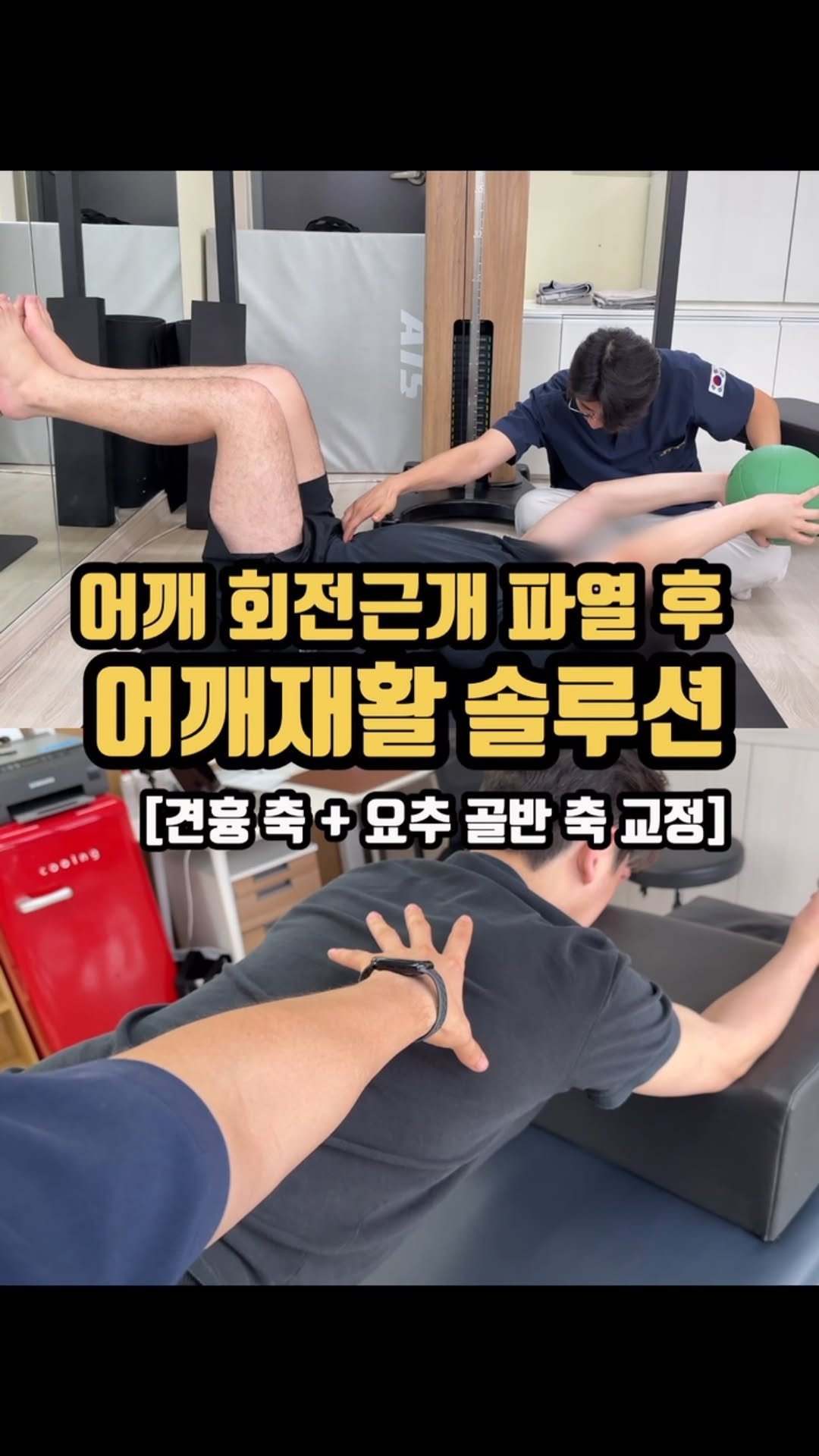 physiolution_21 게시물 이미지: 어깨 회전근개 파열로 인해 두번의 어깨 수술한 고객님이십니다. 회전근개 강화의...