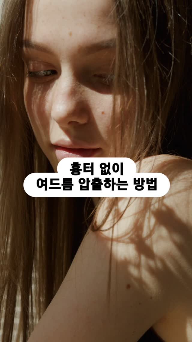 pibu_sister 게시물 이미지: 딱 100원만 준비하세요.

흉터 없이 압출하는데에 필요한건
'기술'이 아닌...