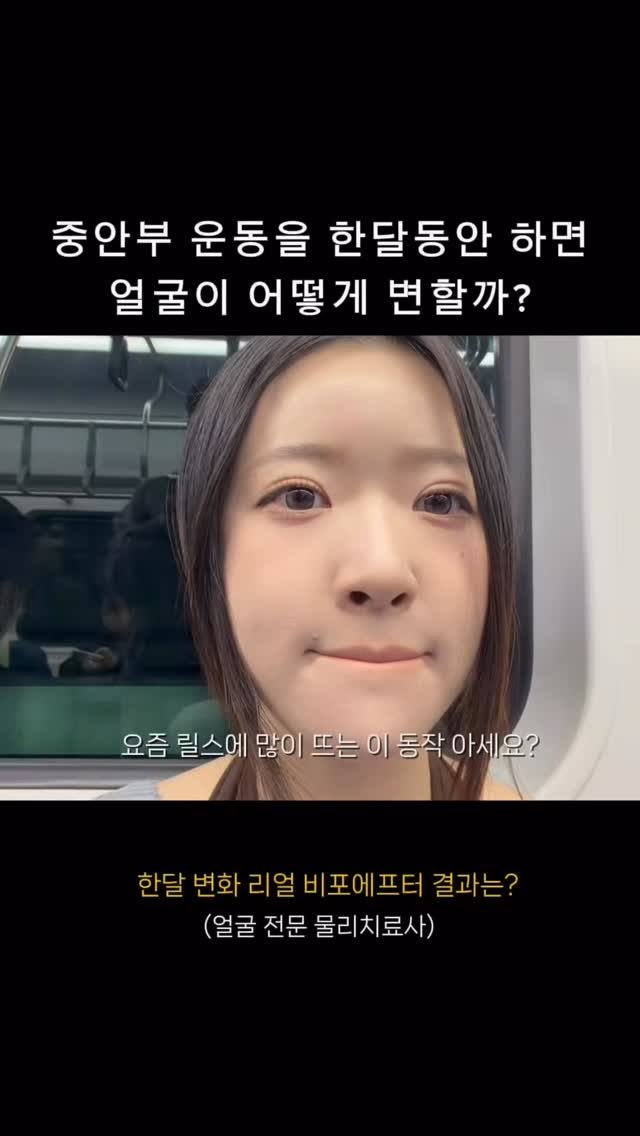 pilafacelab_easy 게시물 이미지: 이 동작 무조건 뜬다..!

왜냐면 왜냐면 효과가 미쳤슨….🙌🏻

얼굴 교정...