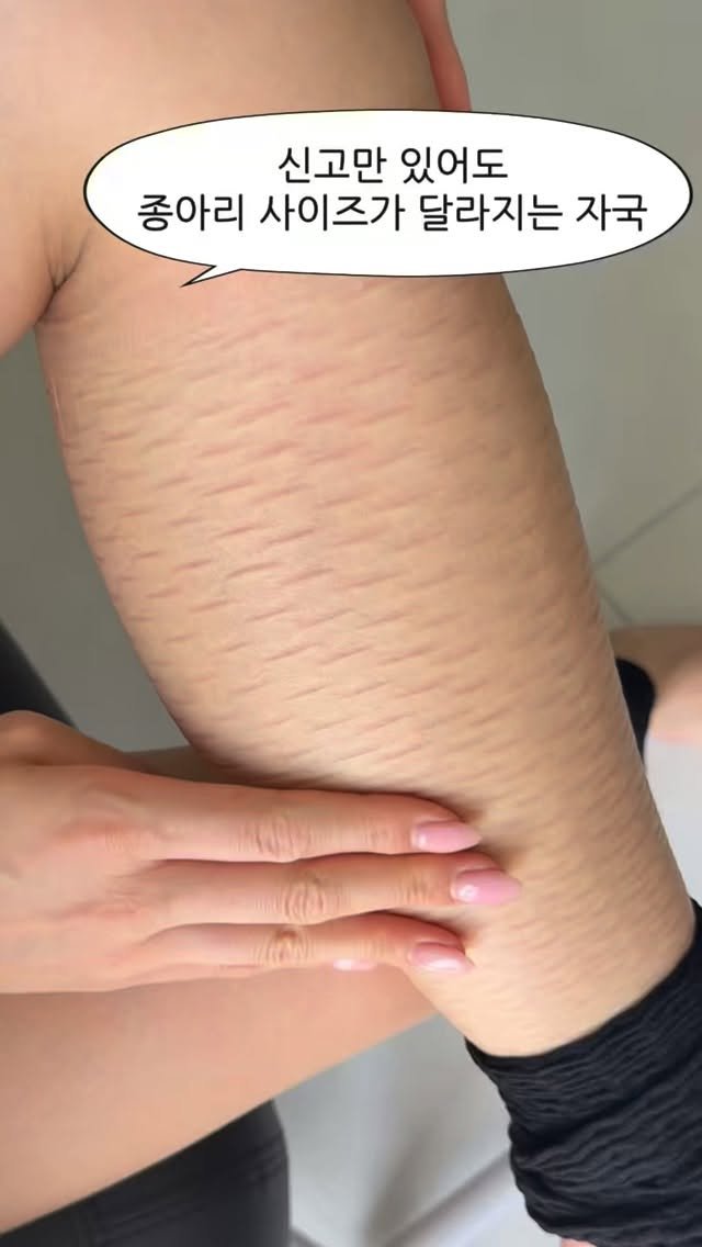 pilatesjane_ 게시물 이미지: ✅댓글에 “종아리” 라고 남겨주시면
 최저가 구매링크 보내드릴게요.

하비탈출하고...