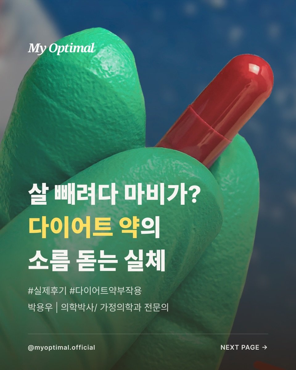 prodieter 게시물 이미지: #실제후기 #다이어트약부작용

”살 빼려다 마비가? 다이어트 약의 소름 돋는...
