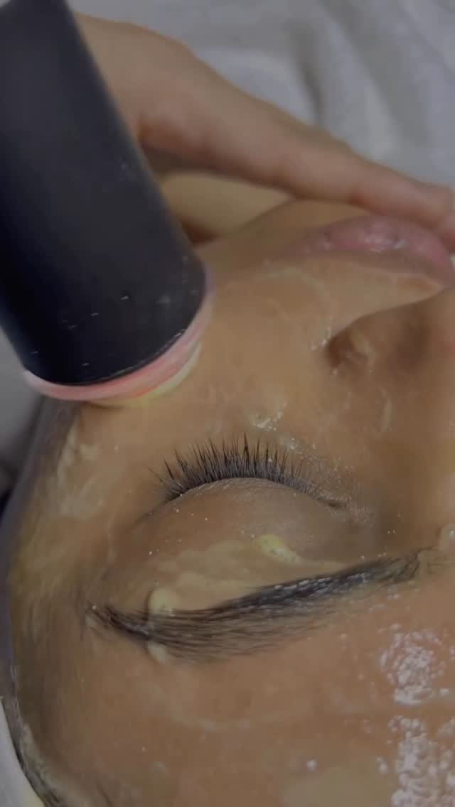 professordrbrajpaltyagi 게시물 이미지: Because your skin deserves a deep cleanse,...