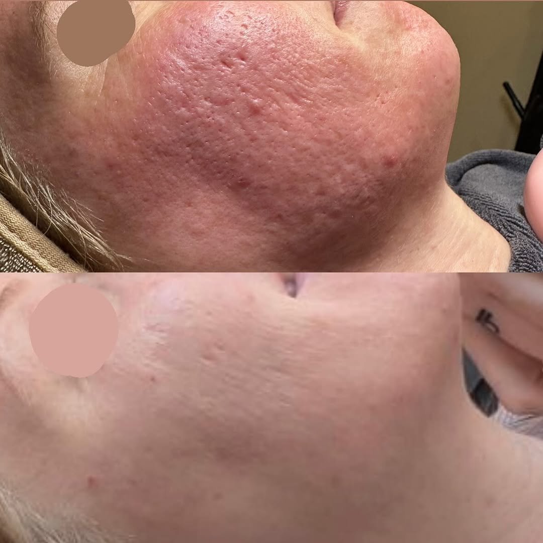 Photo by ADVANCED SKIN TREATMENTS : Your Skins Bestfriend ✨ in Vancouver Island, British Columbia with @thenailloungenanaimo, and @lumie.skinaesthetics.