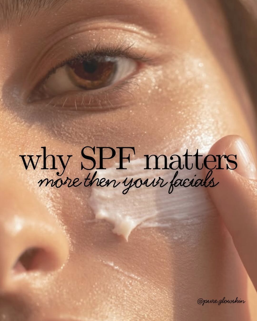 pure.glowskin 게시물 이미지: ✨ Facials help treat the skin, but SPF is what...