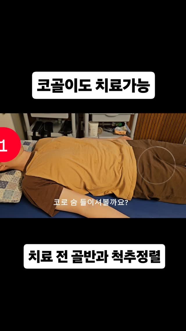 qandapt 게시물 이미지: 환자분의 허리통증, 평발, 족저근막염 등에 근본적인 원인이 코골이도 심하게...