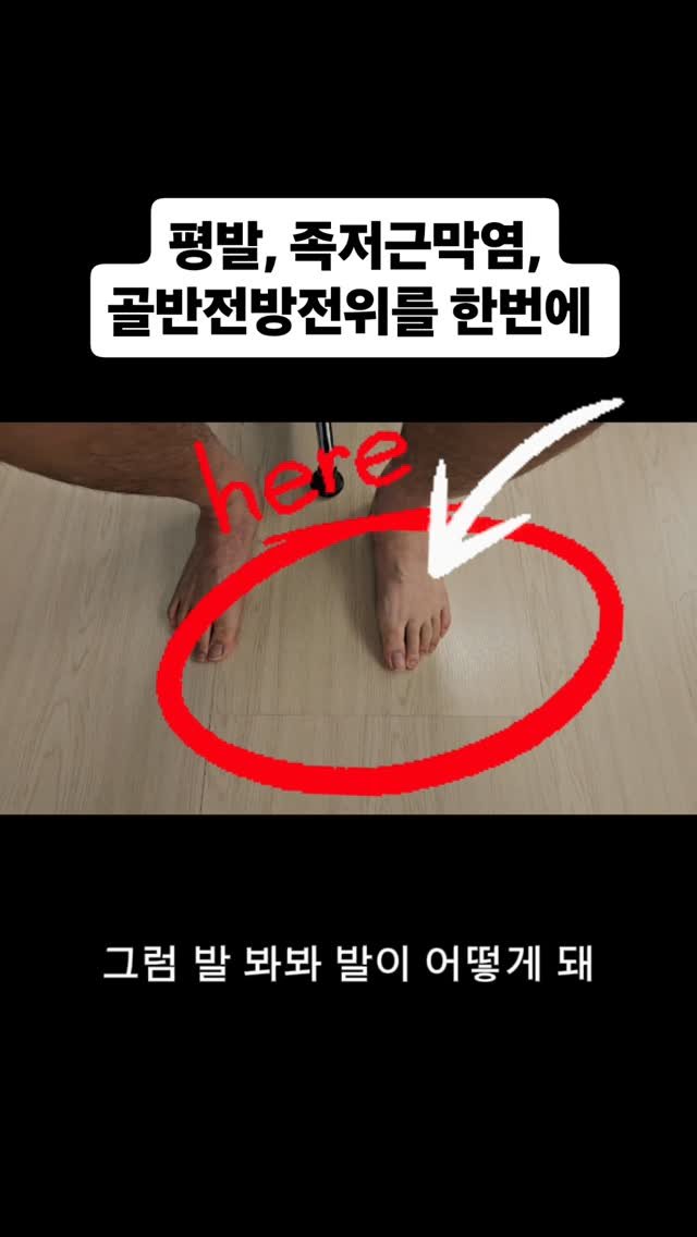 qandapt 게시물 이미지: 영상으로 모든 치료 과정을 다 보여드릴 수는 없답니다
영상의 환자분에게는 다양한...