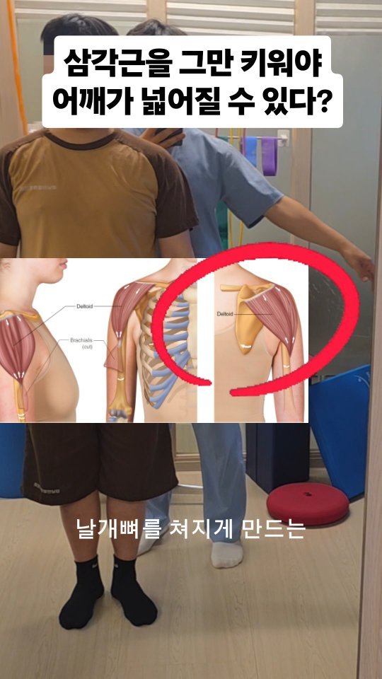 qandapt 게시물 이미지: 어깨를 넓게 만들고 싶다면 사레레를 그만하세요!

✅️영상이 도움이 되셨다면...