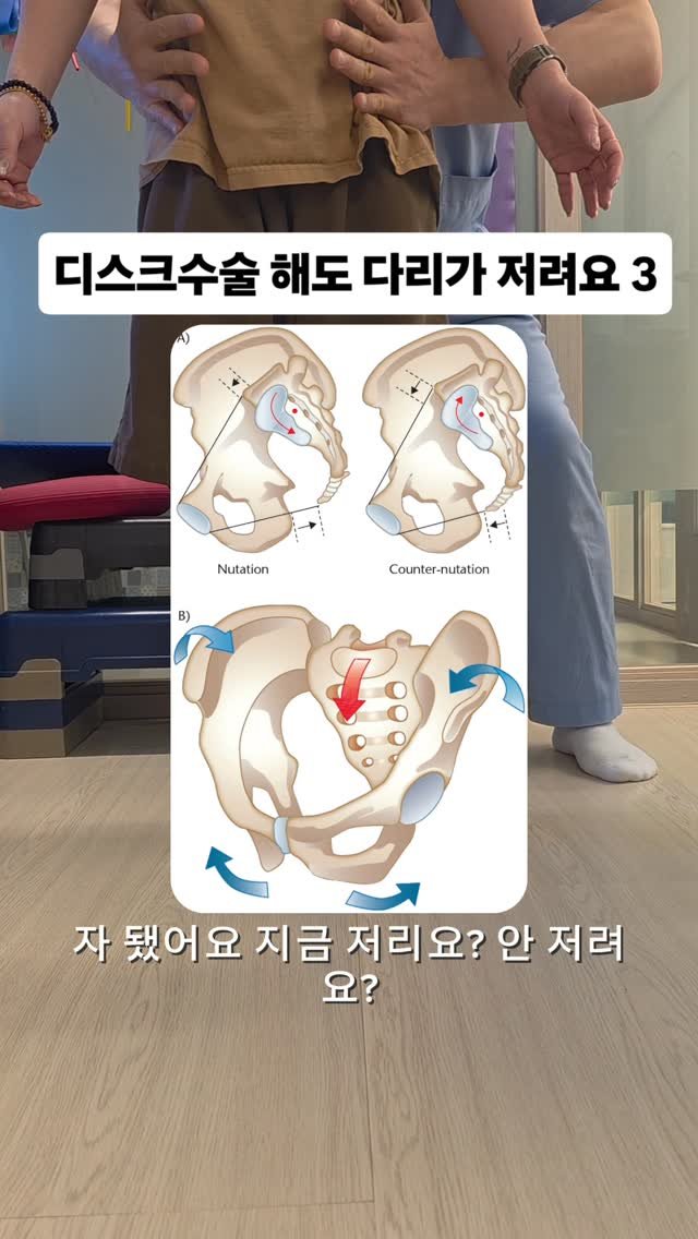 qandapt 게시물 이미지: 저린증상으로 고통받고 있다면 물리치료사에게 치료받으세요
특히 디스크 수술 이후에...
