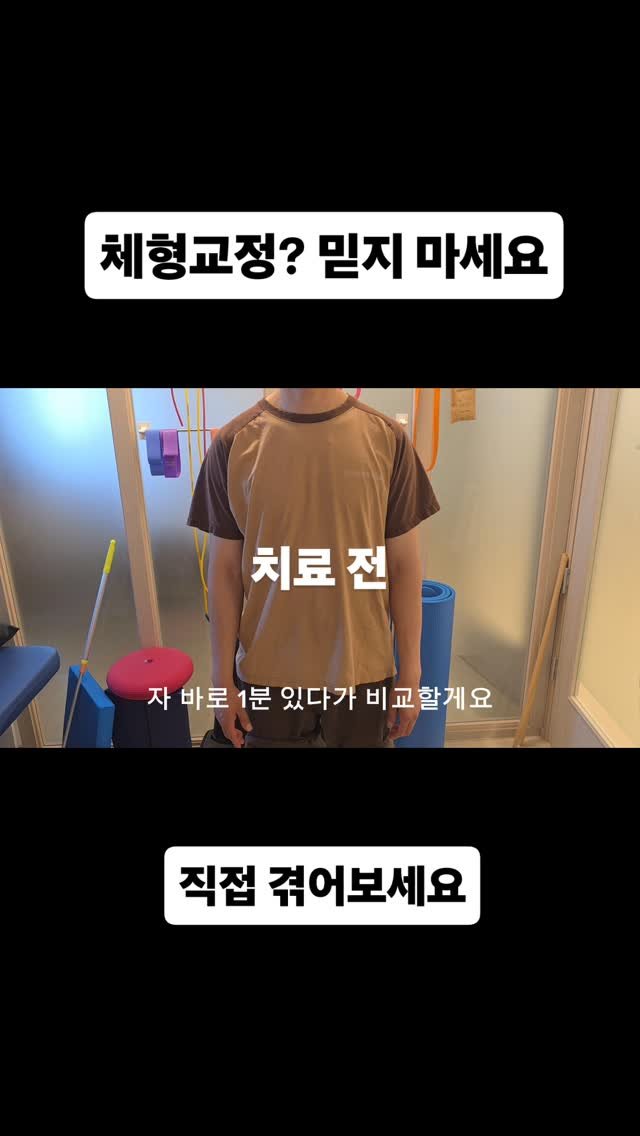 qandapt 게시물 이미지: 직접 겪어보지 않으면 거짓말 같은 물리치료사의 1분!