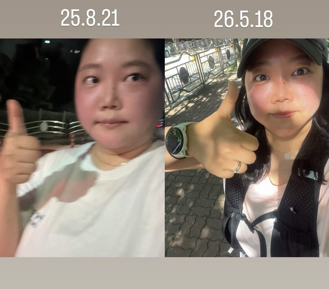 queen_hana93 게시물 이미지: 대사회복 전 후 얼굴 사진 !
-13kg
전신지방흡입, 쥬비X, 다이어트캠프,...